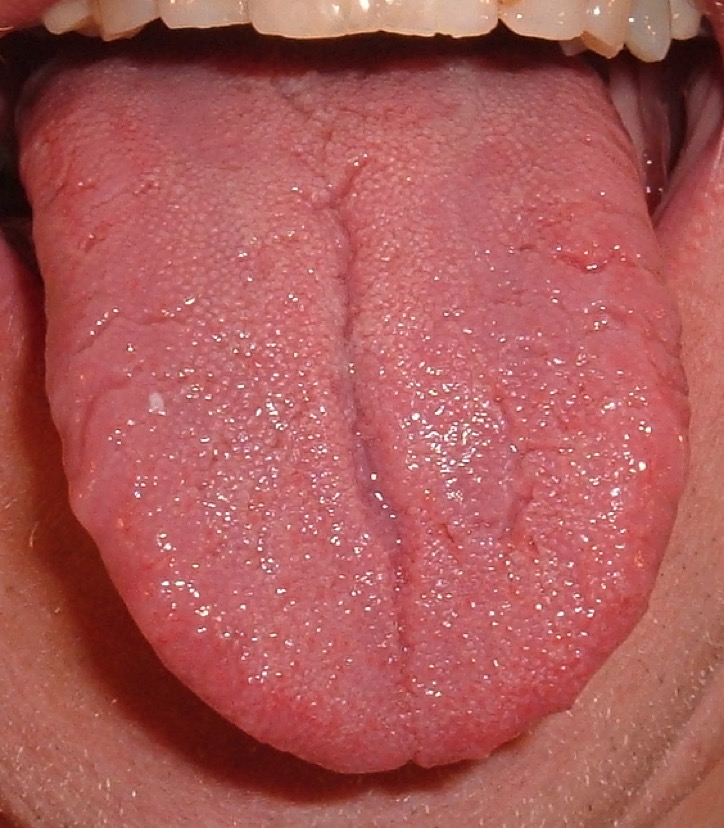tongue